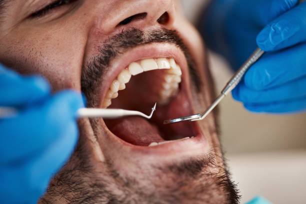 Best Dental Bonding  in Cutchogue, NY